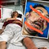 Fiah Qalilah Kamaliah, Wife of BMW Crash Victim, Fights for Rights as Perpetrator Breaks Promises